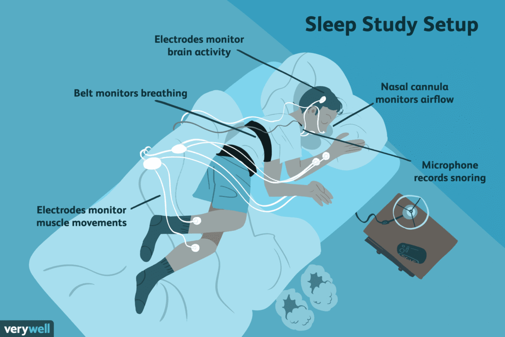 sleep study