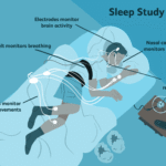 sleep study