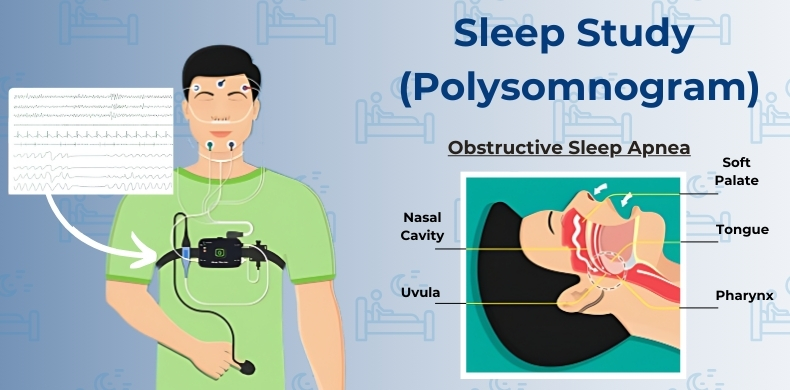 sleep study