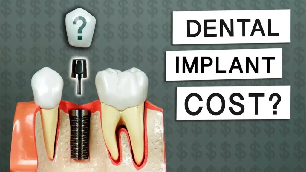 Dental implants cost