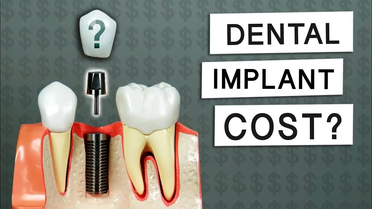 Dental Implants Cost: Global Guide to Pricing and Options