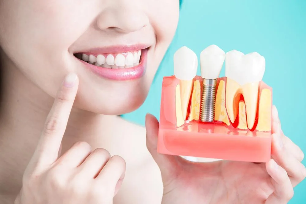 Types of dental implants cost