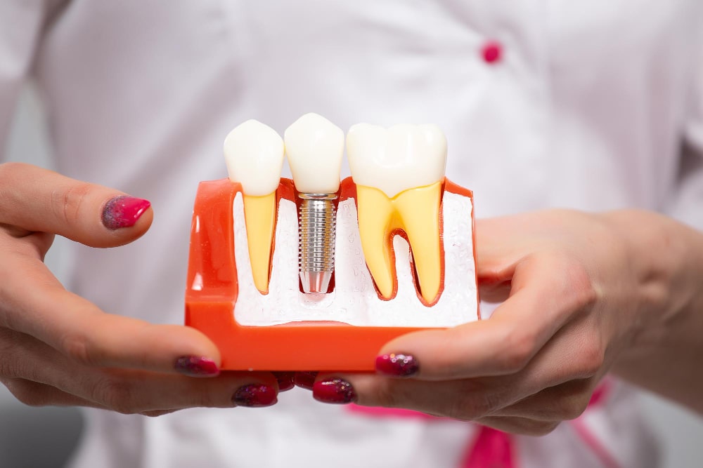 ClearChoice dental implants cost